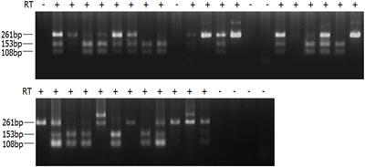 Perspective: Is Random Monoallelic Expression a Contributor to Phenotypic Variability of Autosomal Dominant Disorders?